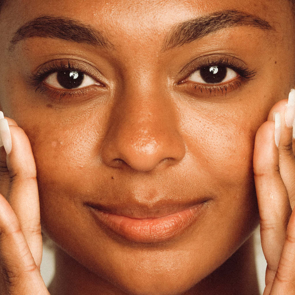 Close-up of a woman's face with hands on her cheeks, focusing on skin texture.